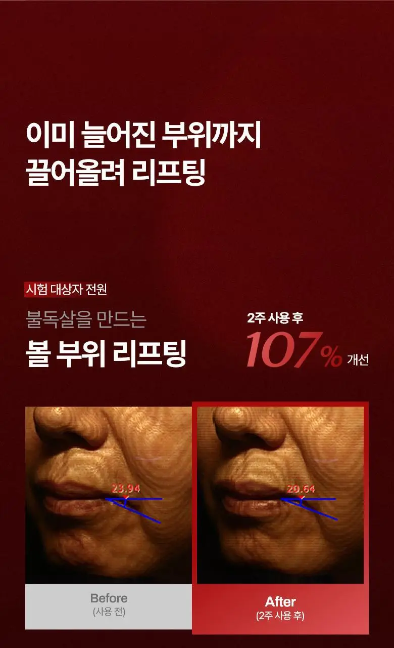 [탄력 리프팅] 메디테라피 링클핏 마스크 7매입 상세페이지 6